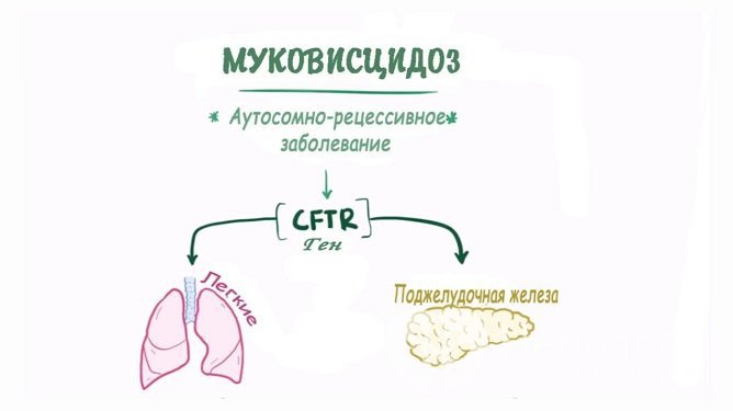 Муковисцидоз поражает весь организм, но в первую очередь поджелудочную железу и бронхолегочную систему