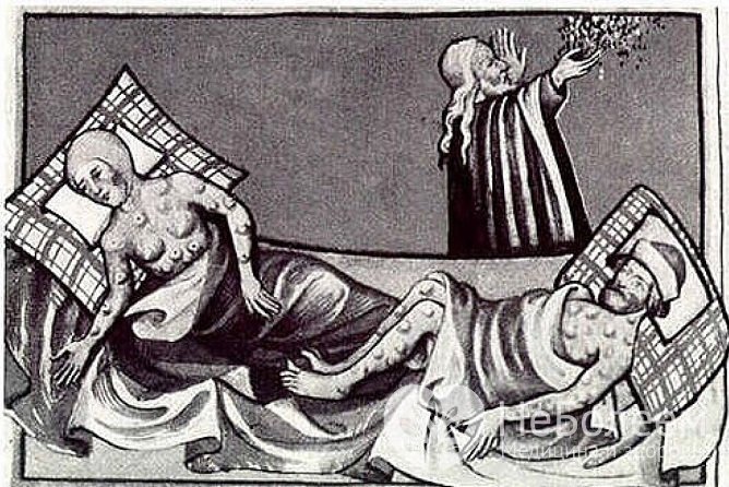 Оспа известна с древних времен, в средневековье она не раз принимала масштаб эпидемий