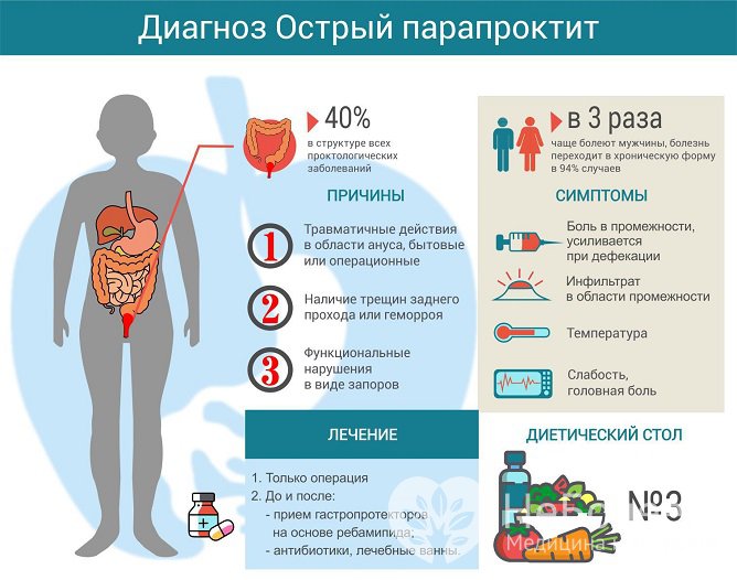 При остром парапроктите следует безотлагательно обратиться к врачу