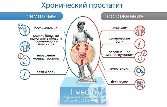 Возможные осложнения хронического простатита