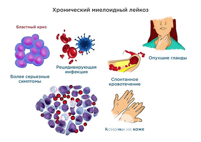 Дополнительные исследования