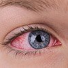 Топ 10 симптомов повреждения глаз