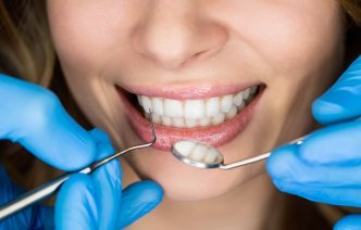 Имплантация стала выходом для тех, кто потерял сразу несколько зубов