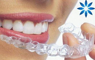 Элайнеры Invisalign в Москве: цена на установку кап в стоматологии ПРОПРИКУС