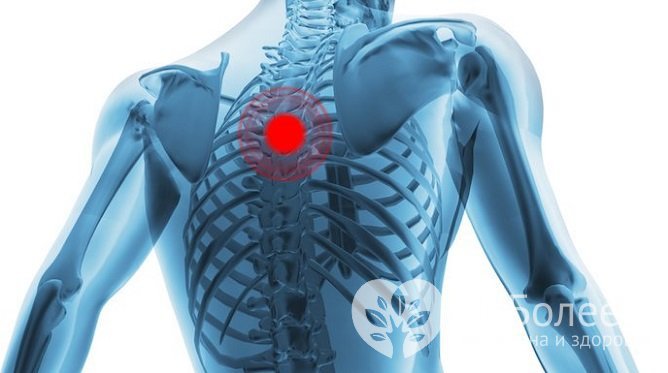 Домашнее лечение грудного остеохондроза должно проводиться под контролем врача, самолечение недопустимо
