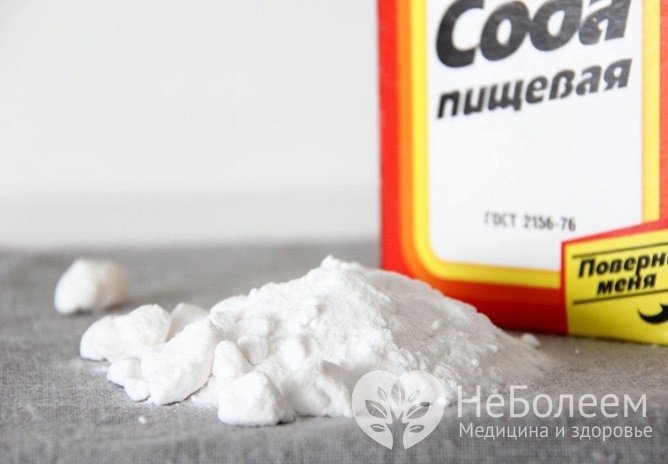 Сода от изжоги: как принимать, плюсы и минусы