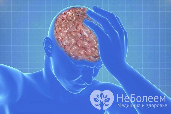 Субдуральная гематома головного мозга: причины, симптомы, лечение, прогноз