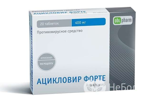 В тяжелых случаях назначается противовирусный препарат Ацикловир